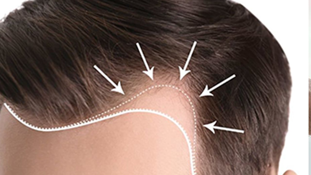 Foto - Saç bakımında iyileşeme hikayesi için önemli: D vitamini eksikliğinde güneş etkili güç!  Ayrıntılar neler ortaya çıktı