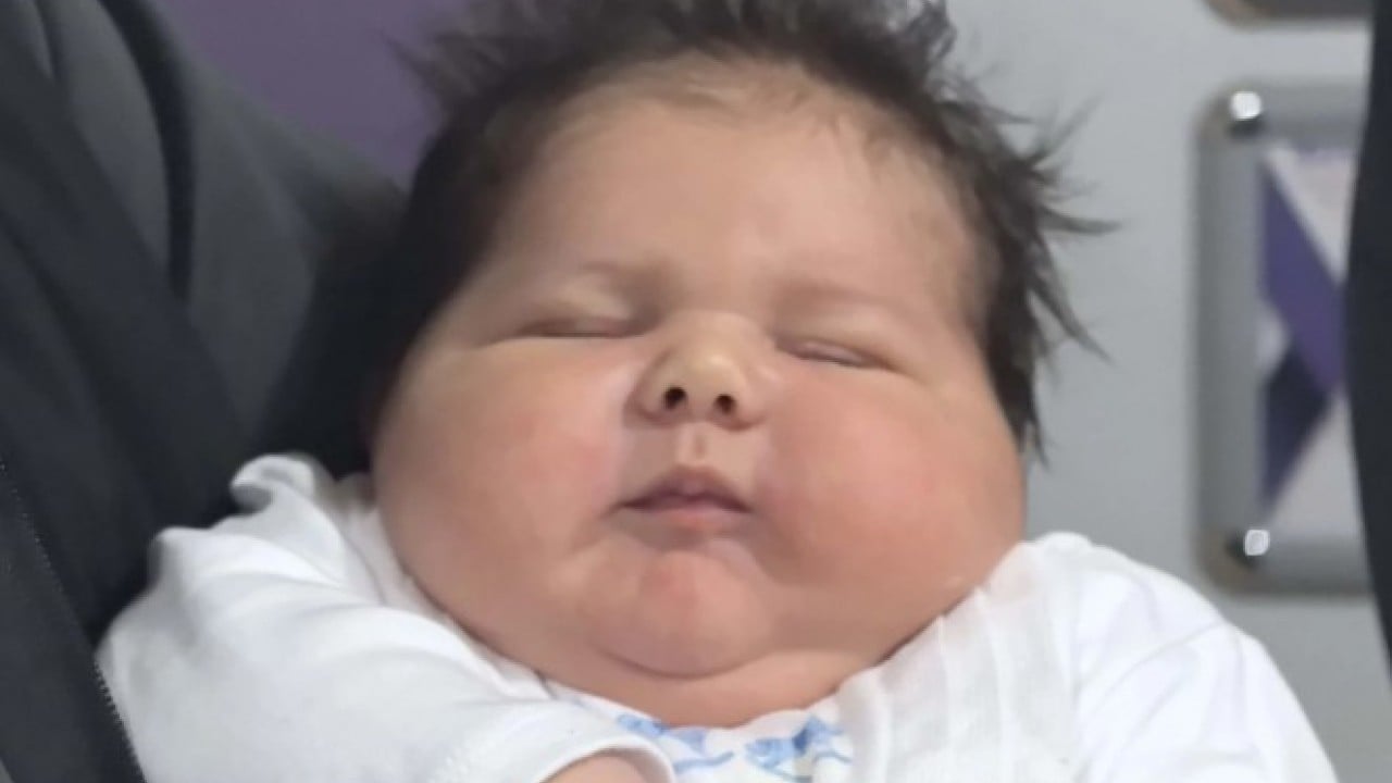 Foto - Türkiye tarihine geçti! 6 kilo 150 gram doğan bebek görenleri şaşırttı