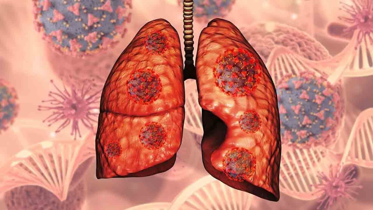 Foto - Türkiye’de her yıl 40 bin kişi akciğer kanseri oluyor!