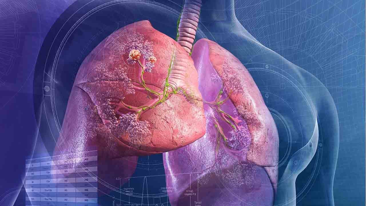 Foto - Türkiye’de her yıl 40 bin kişi akciğer kanseri oluyor!