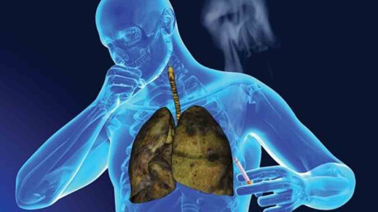 Foto - Türkiye’de her yıl 40 bin kişi akciğer kanseri oluyor!