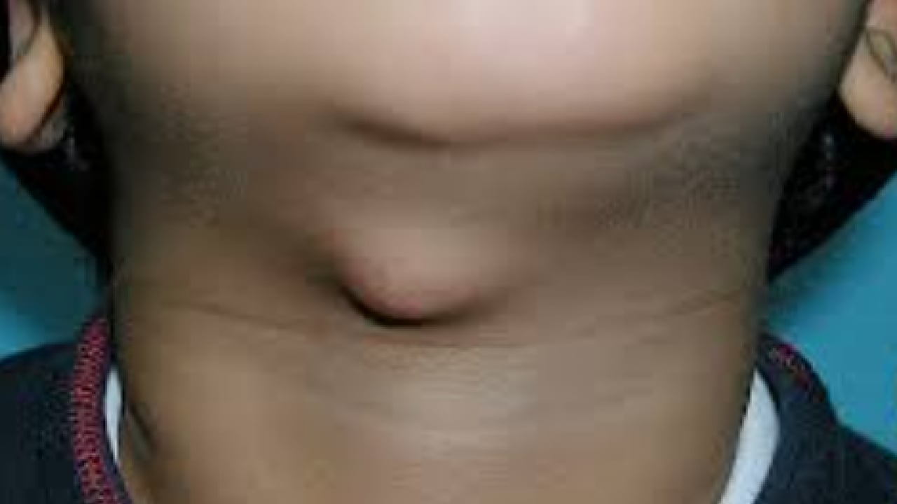 Foto - Üç haftayı geçen şikayetlere dikkat: Kanser belirtisi olabilir