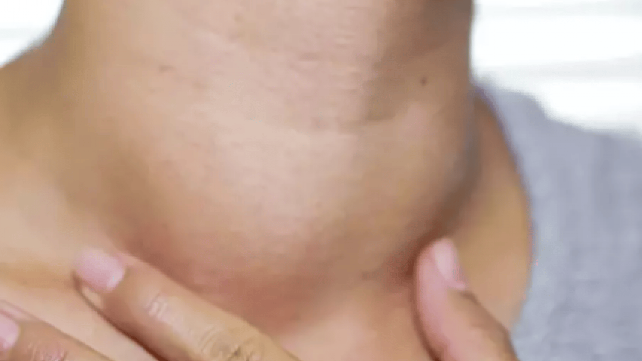 Foto - Üç haftayı geçen şikayetlere dikkat: Kanser belirtisi olabilir