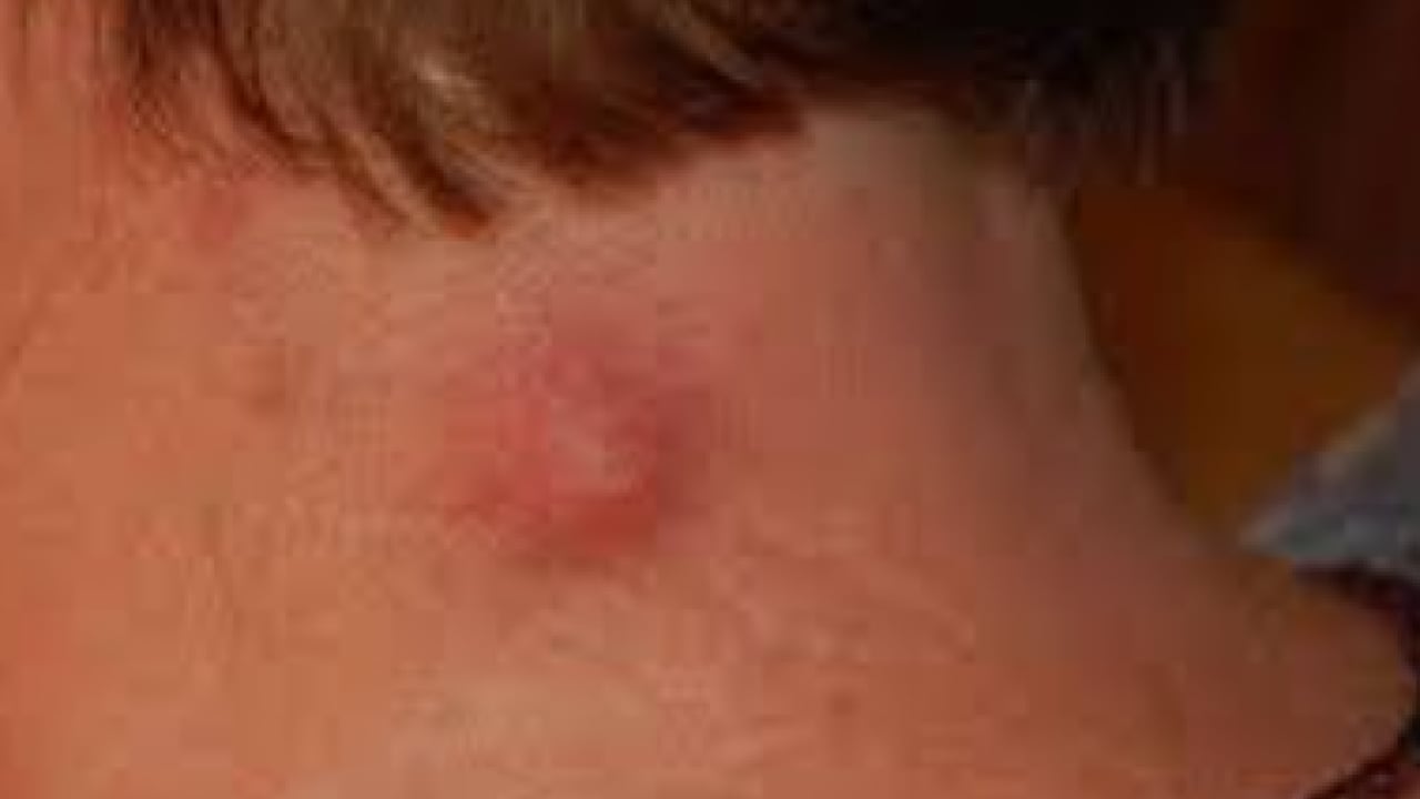 Foto - Üç haftayı geçen şikayetlere dikkat: Kanser belirtisi olabilir