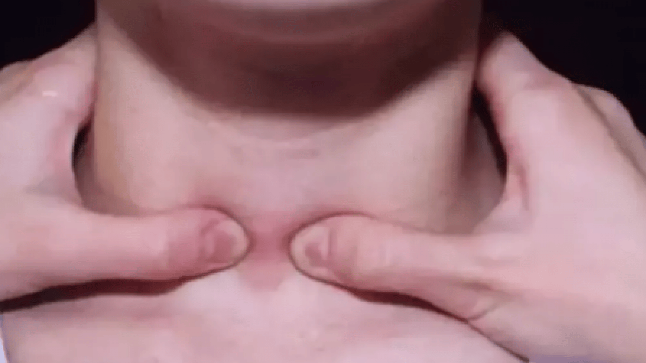 Foto - Üç haftayı geçen şikayetlere dikkat: Kanser belirtisi olabilir