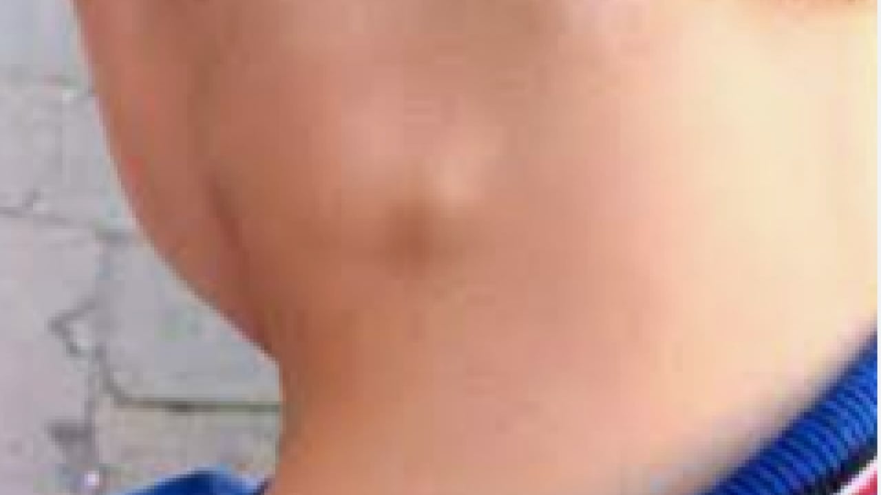 Foto - Üç haftayı geçen şikayetlere dikkat: Kanser belirtisi olabilir