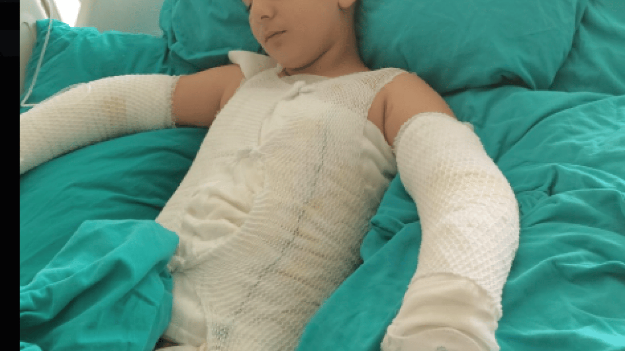 Uçurtma yüzünden canından oluyordu! Babadan ihmal iddiası!