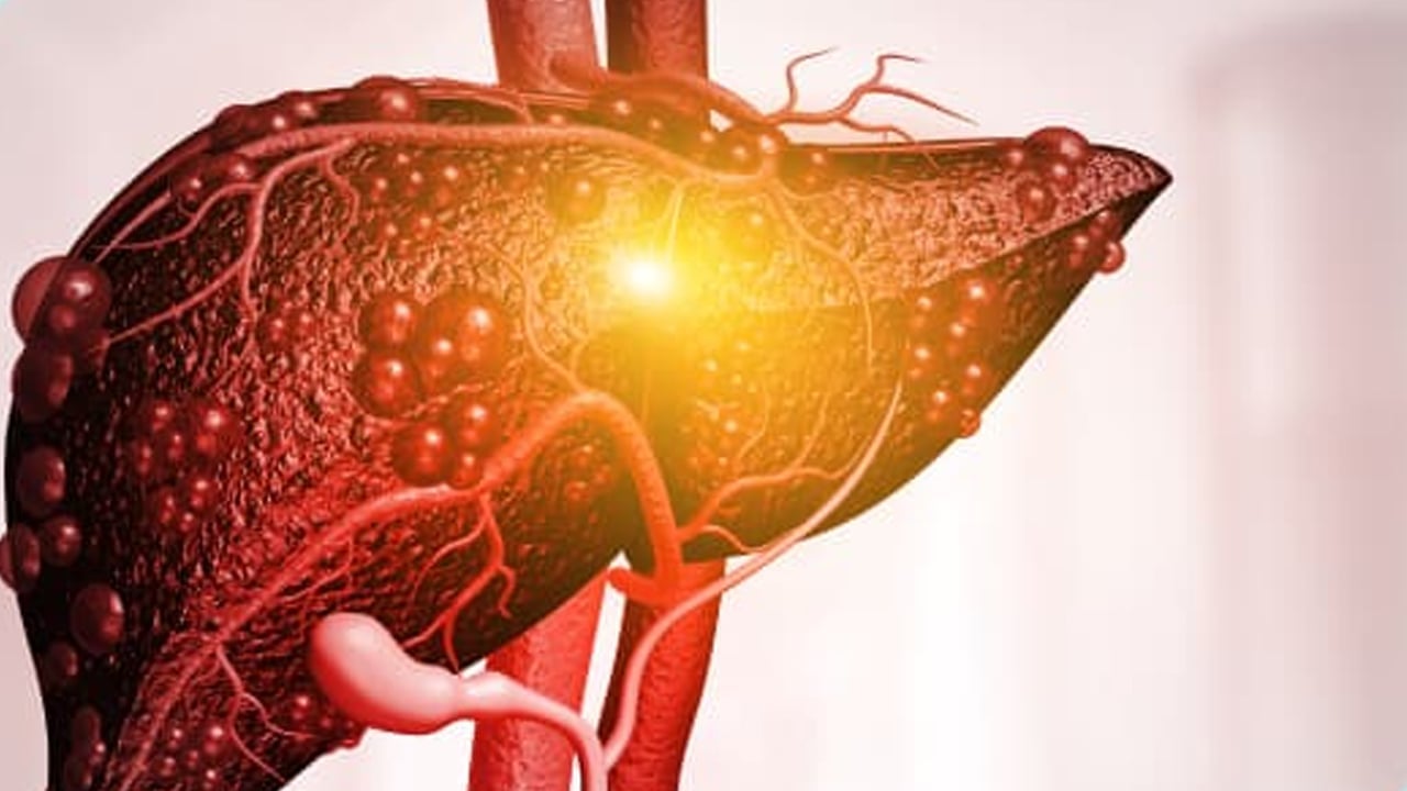 Foto - Ufuk Özkan'ın yaptığı diyet neden yanlış? 1 yıldır karaciğer yetmezliğiyle mücadele ediyordu!