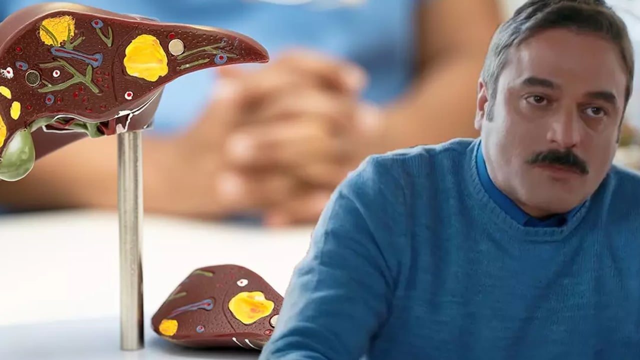 Foto - Ufuk Özkan'ın yaptığı diyet neden yanlış? 1 yıldır karaciğer yetmezliğiyle mücadele ediyordu!