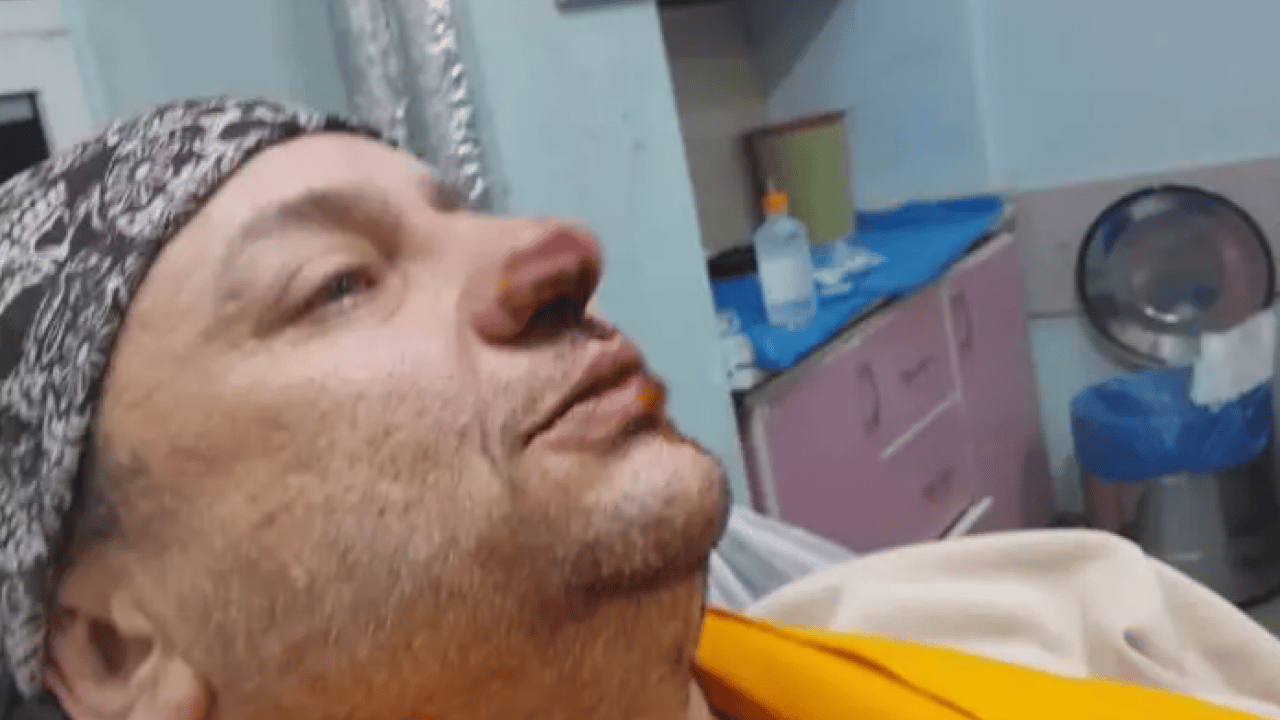 Foto - Başıboş pitbull sanatçının burnunu kopardı! Son durumunu paylaştı!