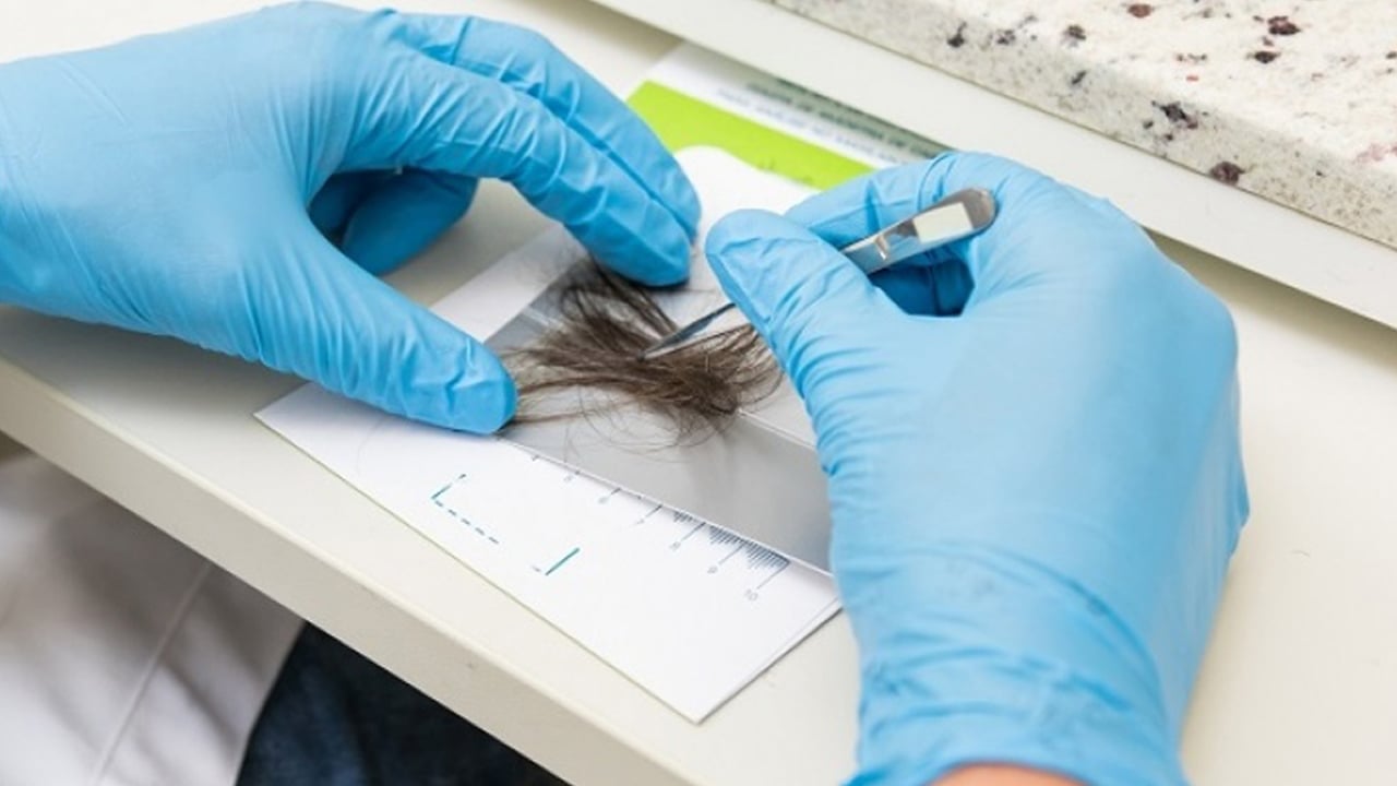 Foto - Ünlülere yönelik operasyonda gelişmeler sonrası merak edildi: Saçtan uyuşturucu testinde hangi uyuşturucular çıkar? 