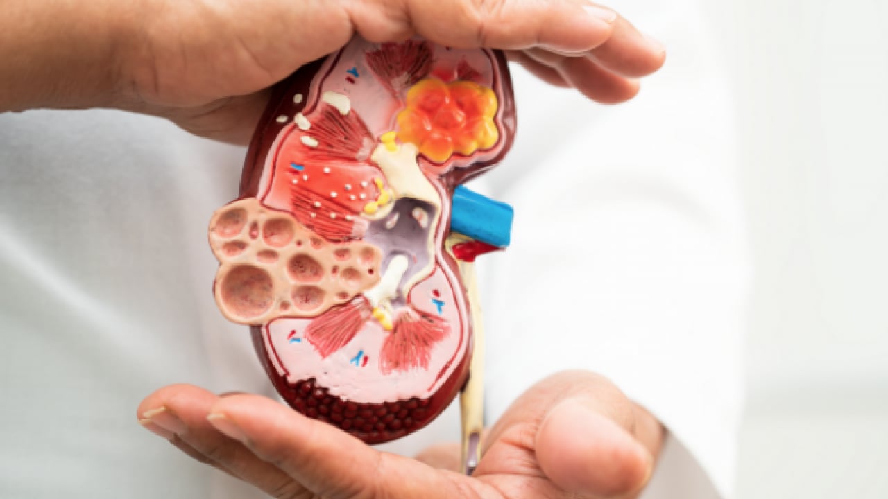 Foto - Üroloji Uzmanı doktor net konuştu: Taş hastalığı böbrek kaybına yol açıyor alarmı...