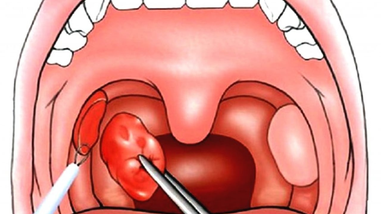 Foto - Uzman uyarısı 2050'ye kadar 10 milyon kişi ölebilir: Bu kez etkisi çok! 
