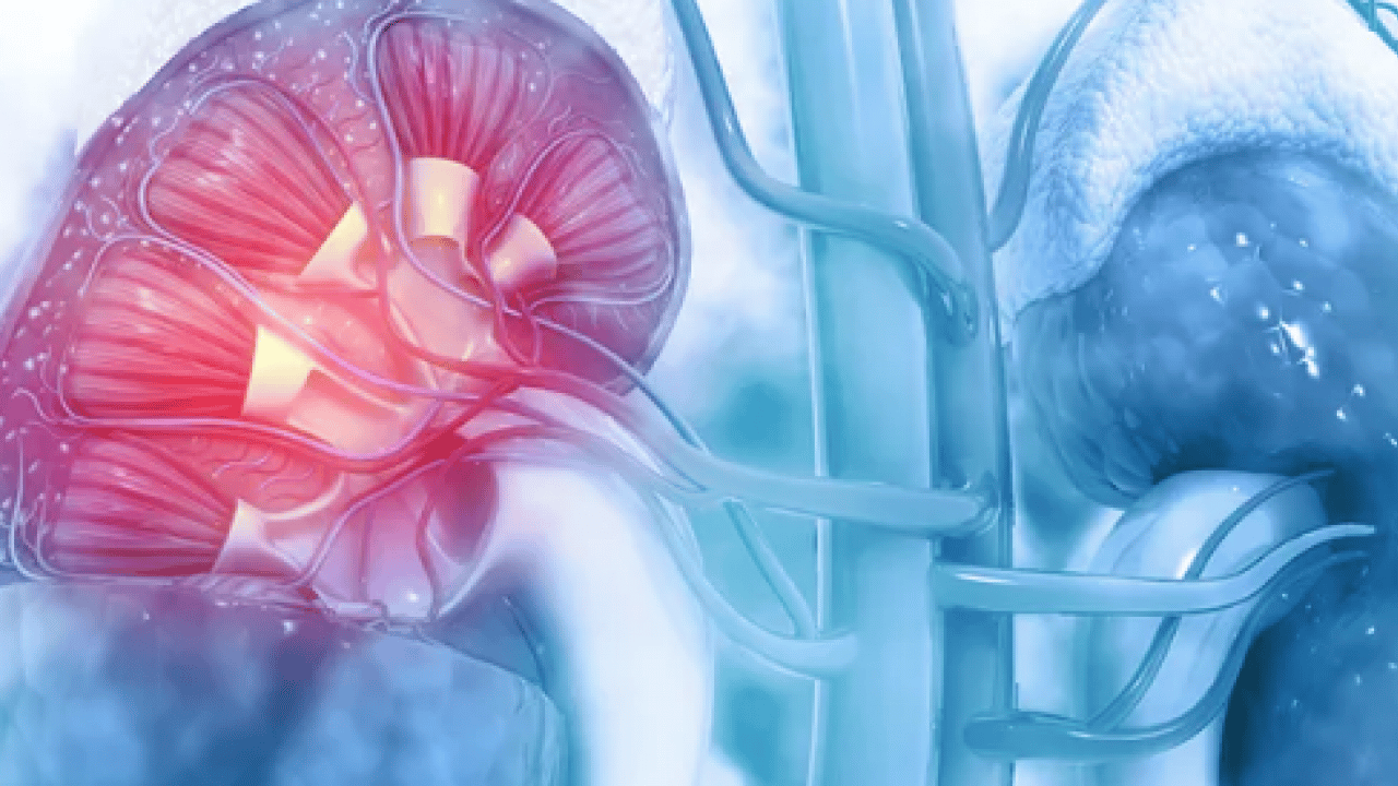 Foto - Uzman isim açıkladı: Doğru beslenme ile böbrek taşı riskini azaltmak mümkün