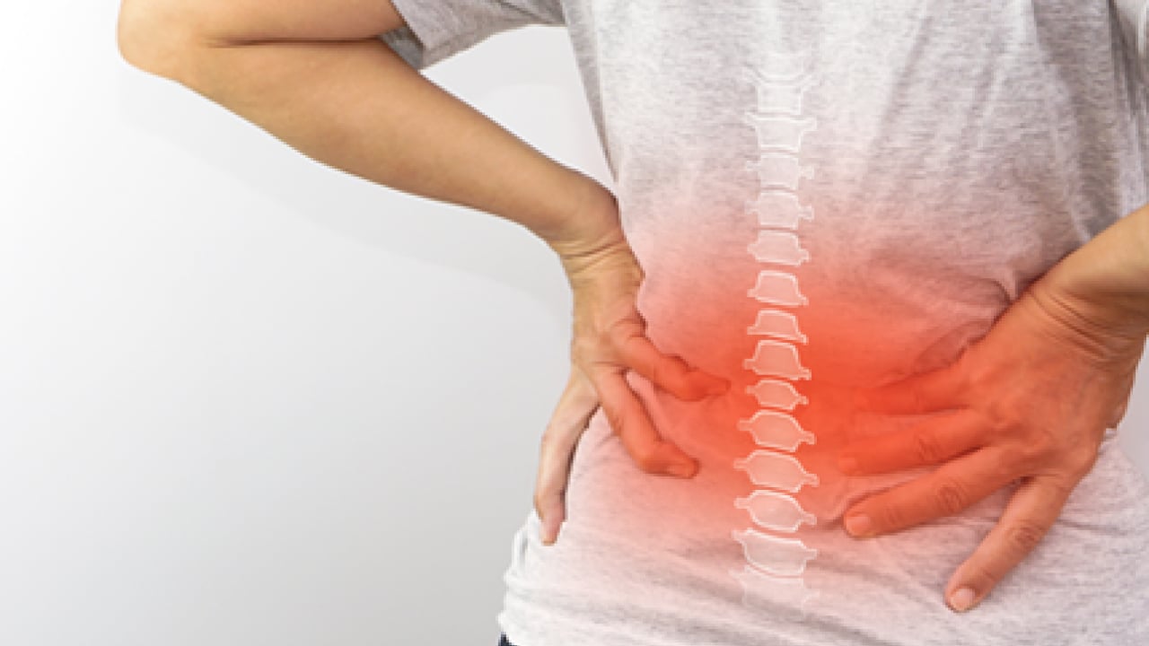 Foto - Uzman isim açıkladı: Dünya çapında yetişkinlerin yüzde 23'üne kadar kronik bel ağrısı vardır