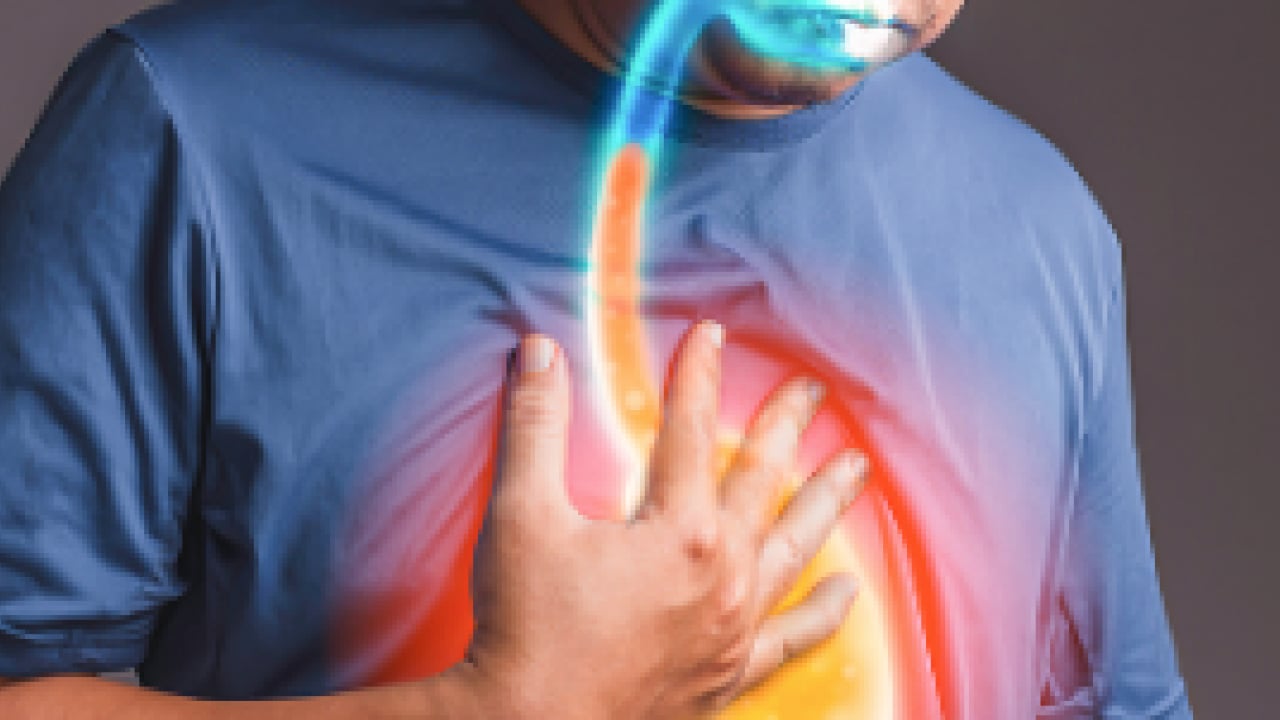 Uzman isim hatayı buldu! Reflü hastalarına altın değerinde tavsiyeler: Ramazan'da dikkat uyarısı