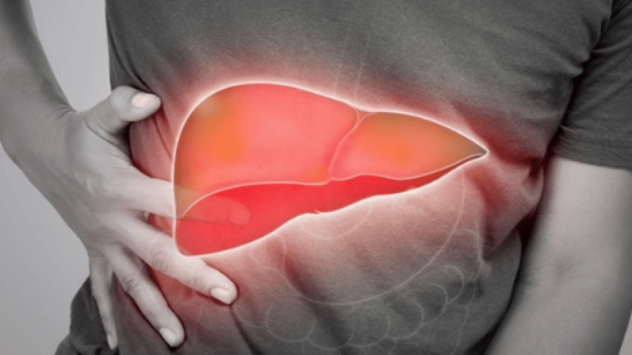 Foto - Uzman isim korkunç haberi verdi: 2050'ye kadar 2 milyar kişi karaciğer hastası olabilir! 