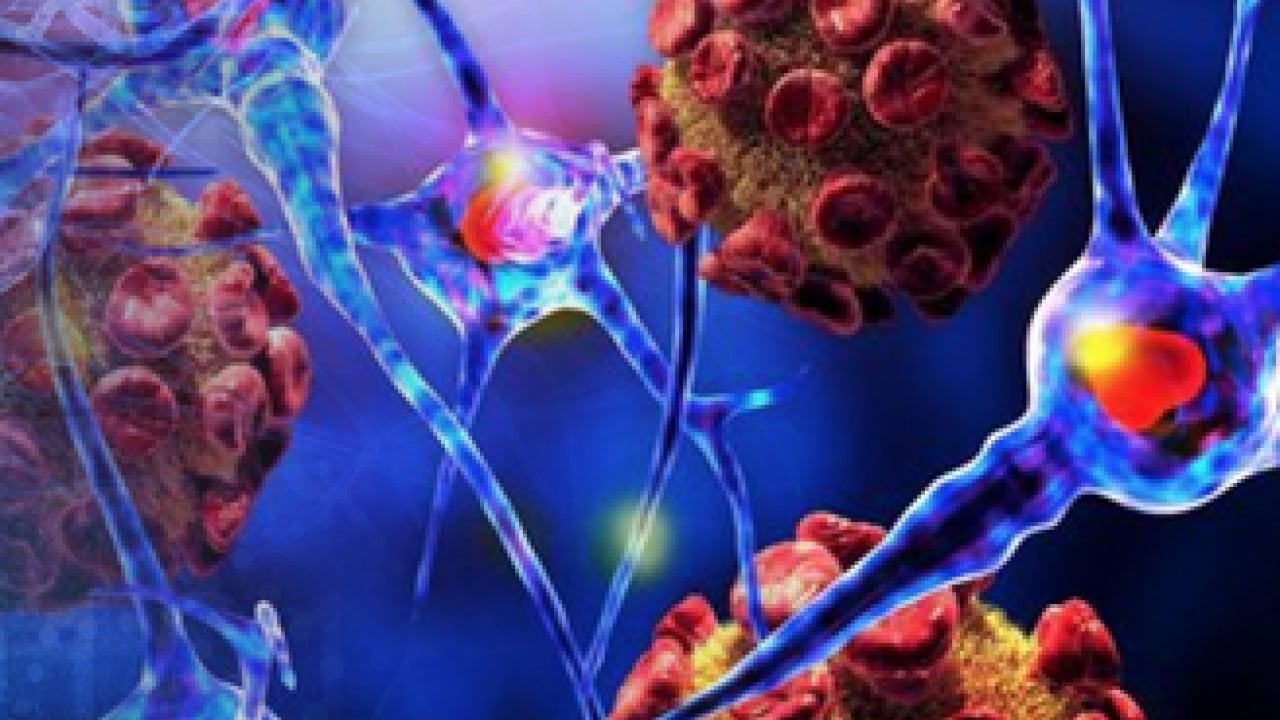 Uzman isim tek tek açıkladı: Parkinson hastalığında 'koku kaybı' erken uyarı...