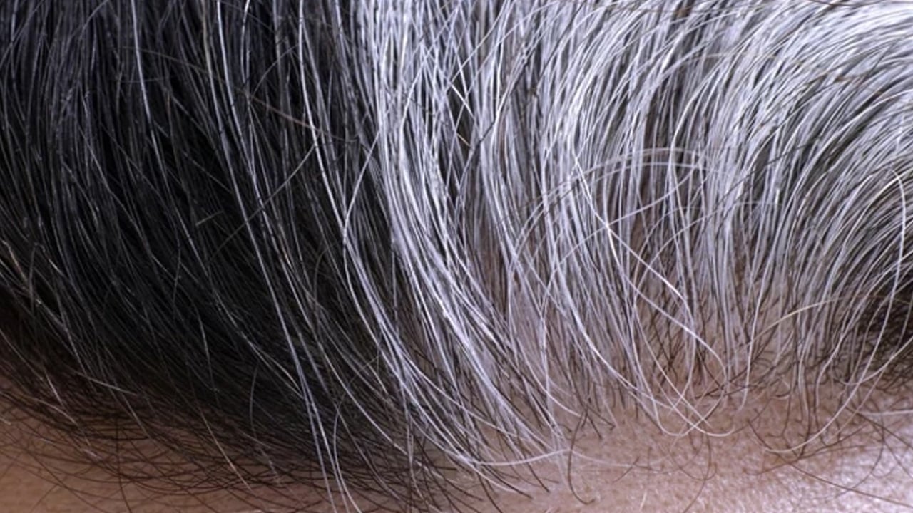 Foto - Uzman isim uyardı! Saç dökülmesi yaşayanlar uzun süre dikkat: Sorun herkesin sandığı gibi olmayabilir