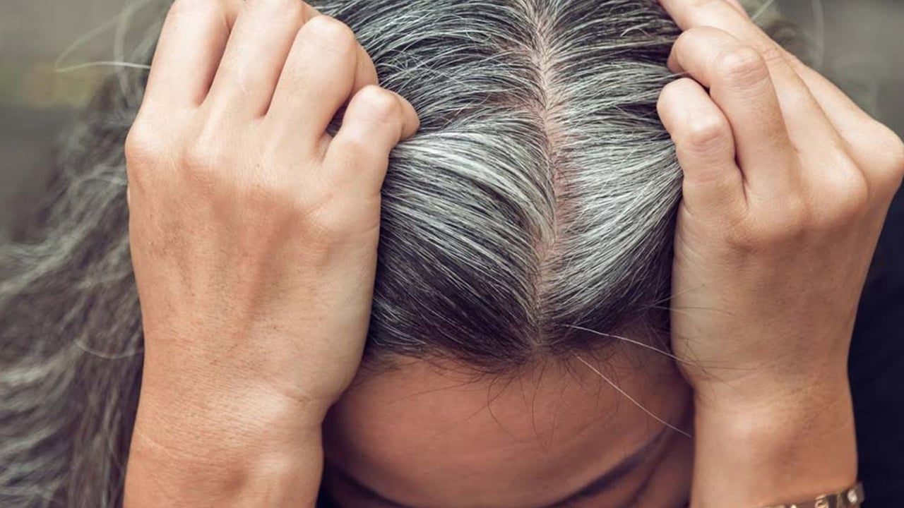 Foto - Uzman isim uyardı! Saç dökülmesi yaşayanlar uzun süre dikkat: Sorun herkesin sandığı gibi olmayabilir