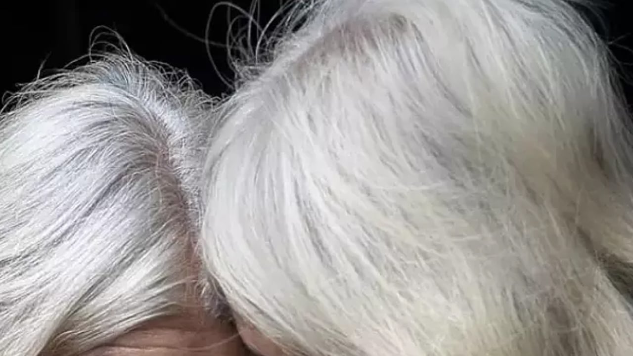 Foto - Uzman isim uyardı! Saç dökülmesi yaşayanlar uzun süre dikkat: Sorun herkesin sandığı gibi olmayabilir