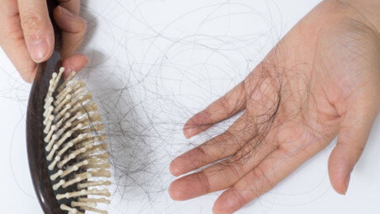 Foto - Uzman isim uyardı! Saç dökülmesi yaşayanlar uzun süre dikkat: Sorun herkesin sandığı gibi olmayabilir