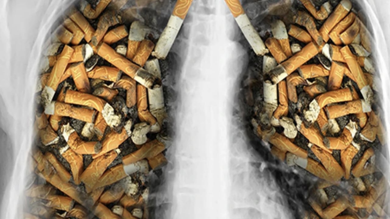 Foto - Uzman isim uyardı: KOAH’ta en büyük risk sigara! En büyük risk ortada...