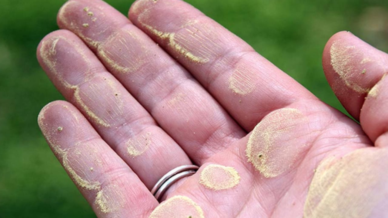 Foto - Uzman isim uyardı ve her şeyi tek tek anlattı! Gözlerde sulanma, kızarma, yorgunluk...