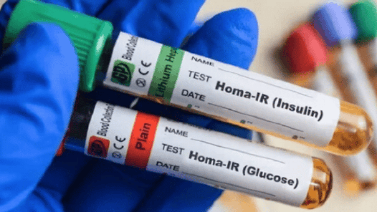 Foto - Uzman isim uyarıyor: Gizli tehlike: Açlık insülini neden hayati önem taşıyor?