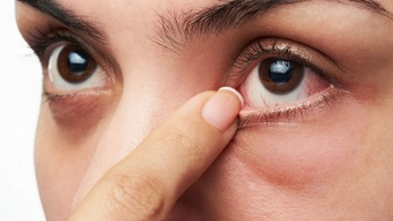 Foto - Uzman isimden çok ciddi uyarı! Bahar aylarındaki göz alerjisi görme kaybına yol açabilir...