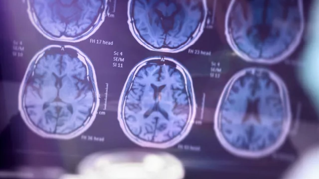 Foto - Uzmana kulak verin: Hastalıkların gizli kaynağı! Pestisitlerden kurtulmanın formülü: 1 litre suya 5 kaşık...