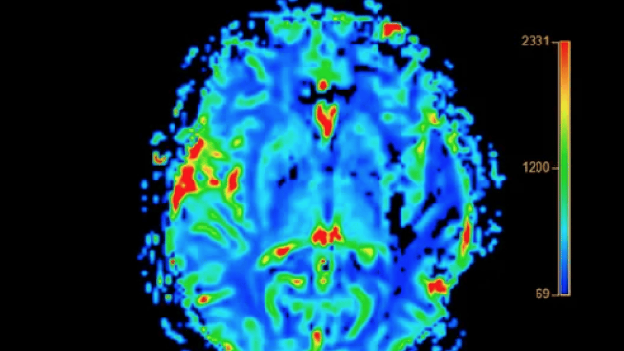 Foto - Uzmana kulak verin: Hastalıkların gizli kaynağı! Pestisitlerden kurtulmanın formülü: 1 litre suya 5 kaşık...