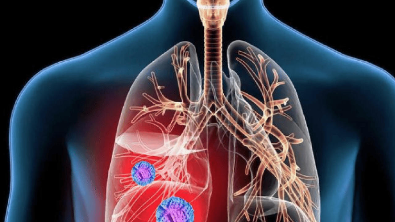 Foto - Uzmandan kronik akciğer hastalarına 'hareket' çağrısı! Pulmoner rehabilitasyon ile destek...