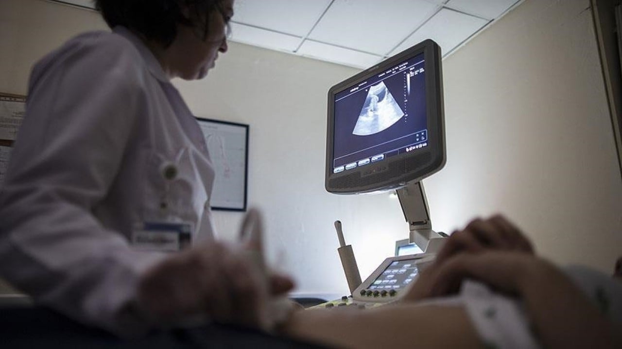 Foto - Uzmanı açıkladı: Her 10 kadından biri ‘çikolata kisti’ ile yaşıyor