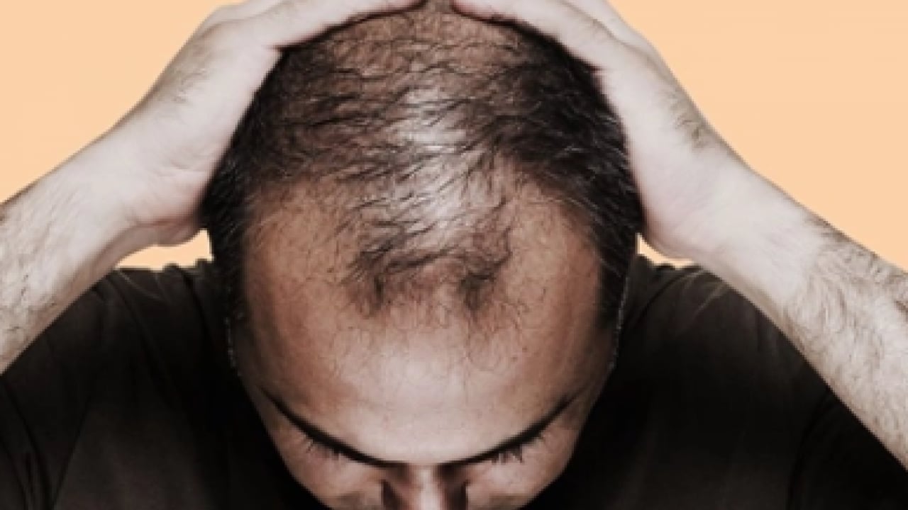 Foto - Uzmanı ‘bunu asla yapmayın’ dedi! Saç dökülmesi sorunu yaşayanlar dikkat