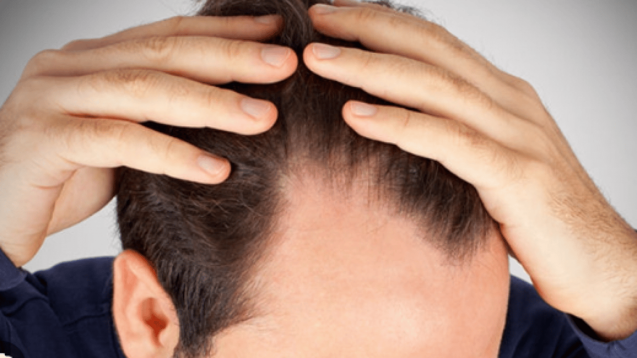 Foto - Uzmanı ‘bunu asla yapmayın’ dedi! Saç dökülmesi sorunu yaşayanlar dikkat