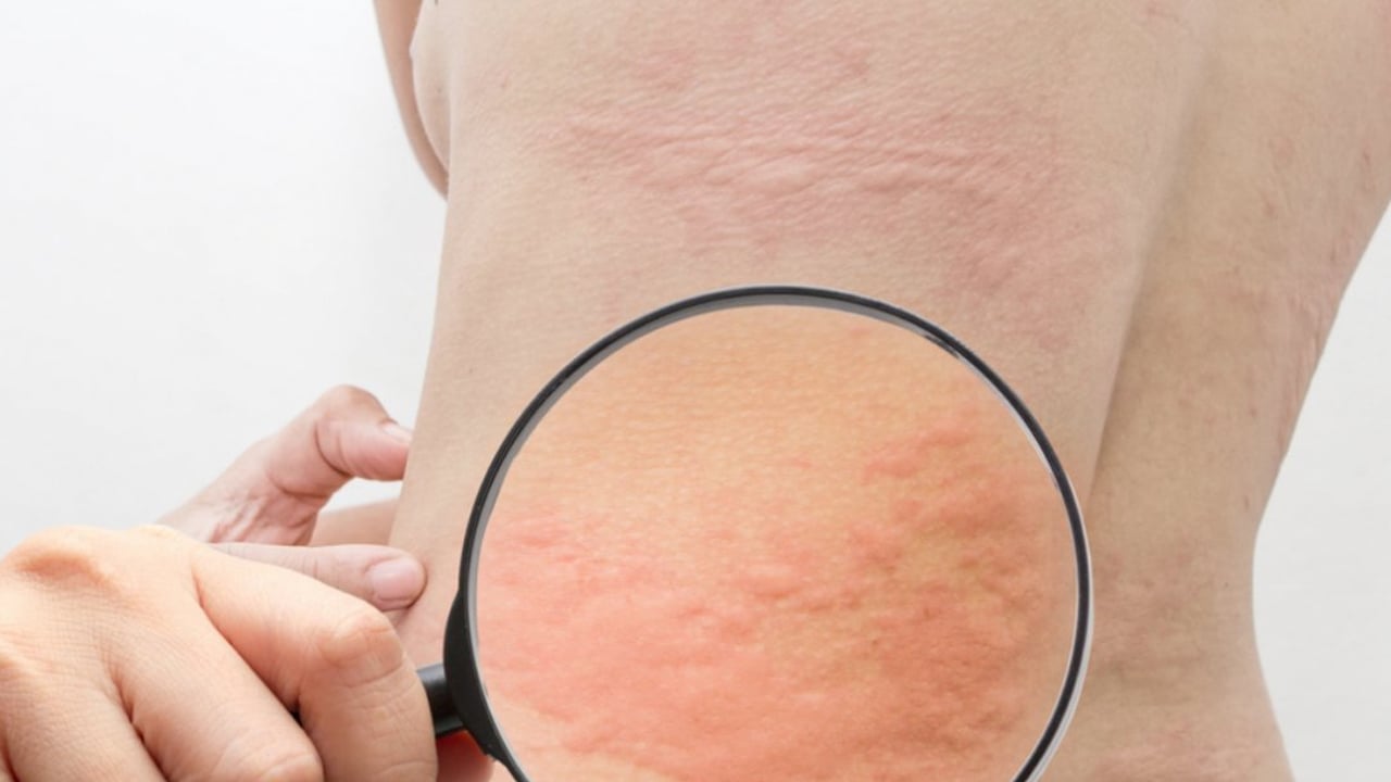 Foto - Uzmanı mesajı verdi: Besini tüketirken çözüm değil aksine bu hata kısa süre el ve ayaklarda şişmeye neden oluyor