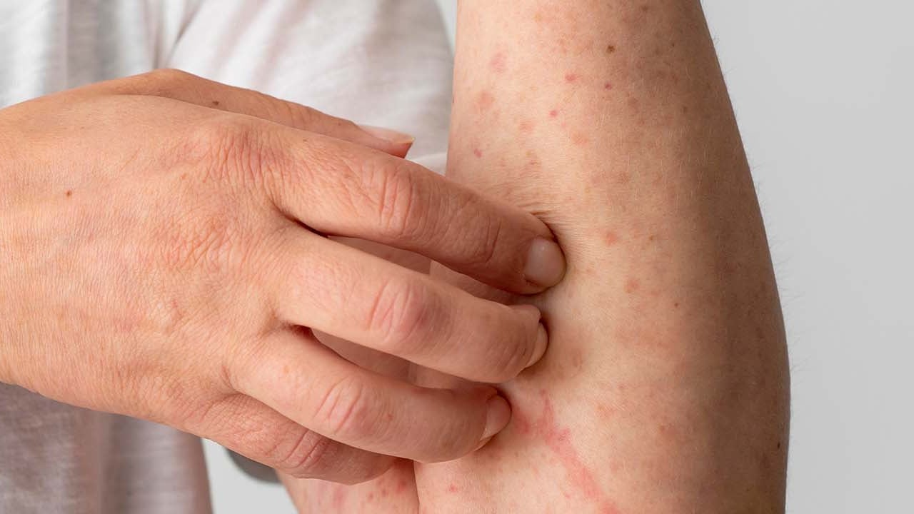 Foto - Uzmanı mesajı verdi: Besini tüketirken çözüm değil aksine bu hata kısa süre el ve ayaklarda şişmeye neden oluyor