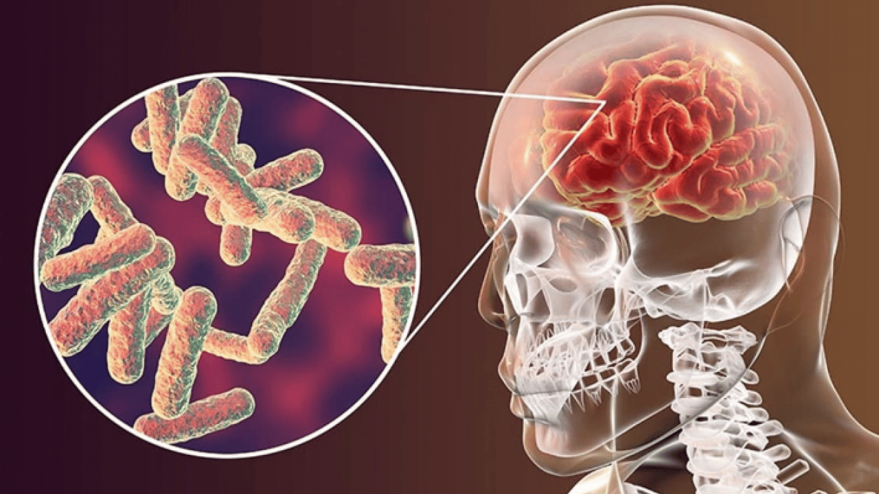 Foto - Doktor net konuştu: Menenjit hastalığından korunmanın en etkili yolu aşılanmaktır