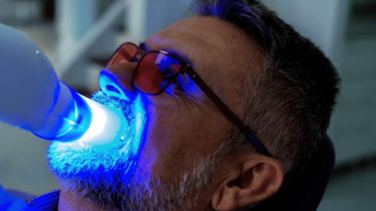 Foto - Uzmanı uyardı: Gülümseme uğruna sağlığınızdan olmayın!