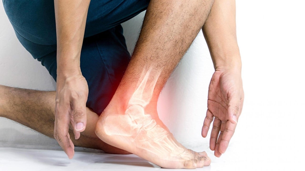 Foto - Uzmanı uyardı! Çatlak deyip geçmeyin