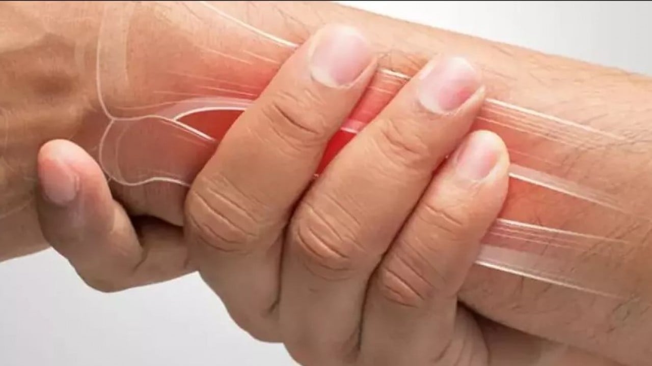 Foto - Uzmanı uyardı! Çatlak deyip geçmeyin