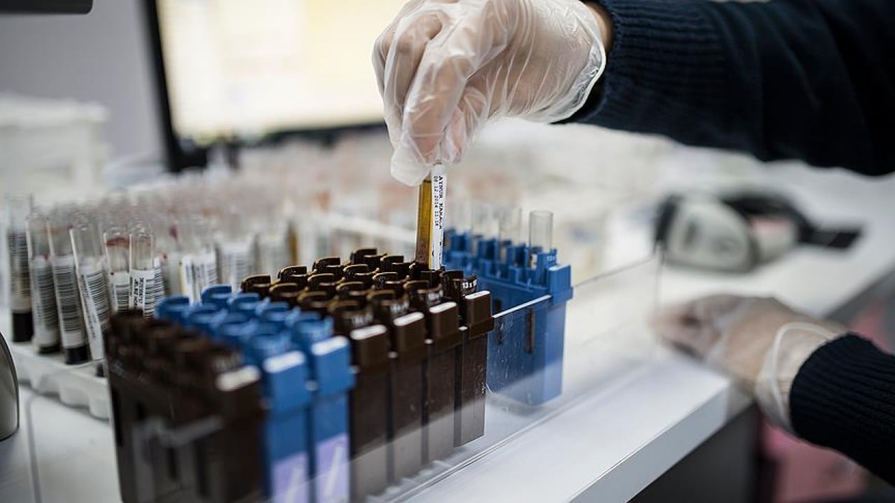 Foto - Uzmanından dikkat çeken uyarı! Annedeki o sorun bebeğinde hemofiliye yol açabiliyor