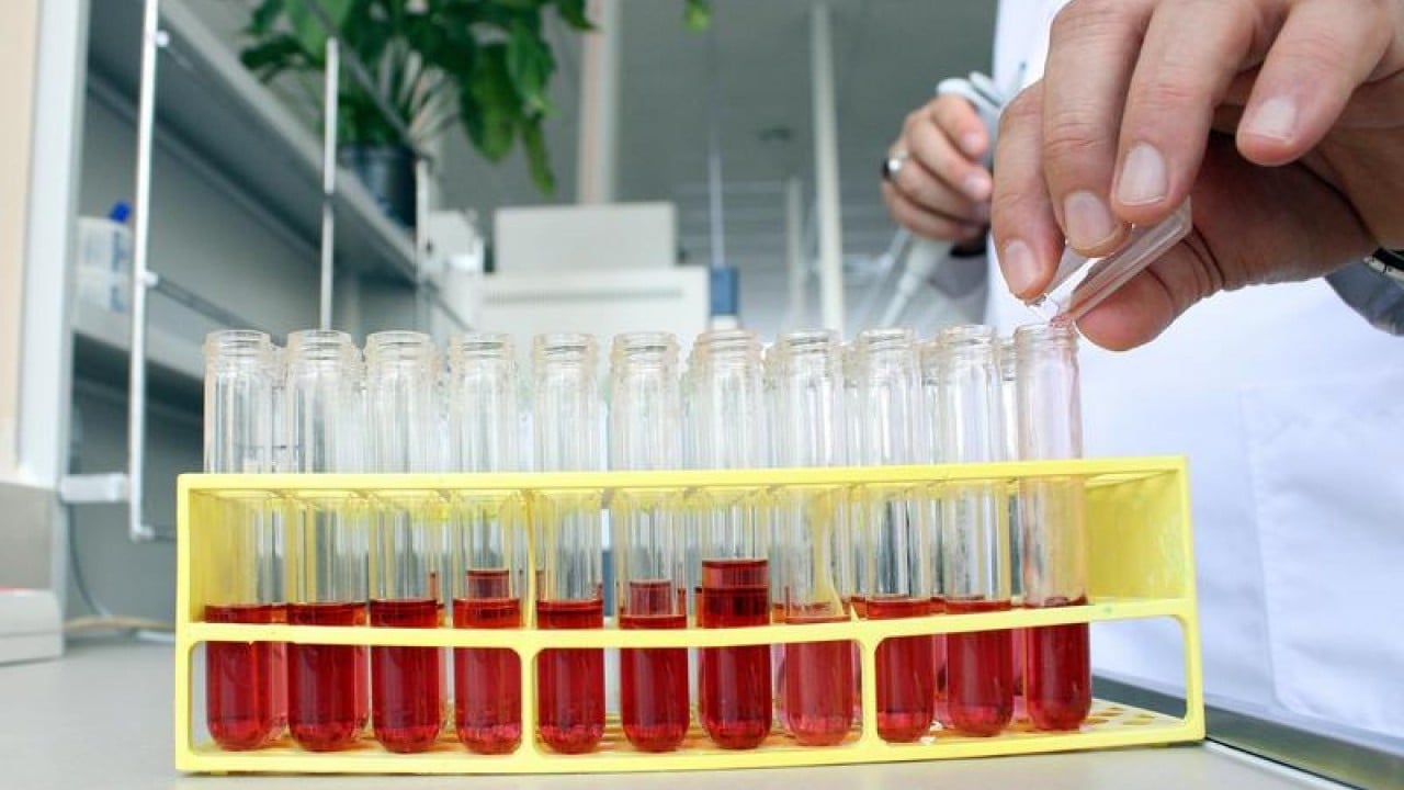 Foto - Uzmanından dikkat çeken uyarı! Annedeki o sorun bebeğinde hemofiliye yol açabiliyor