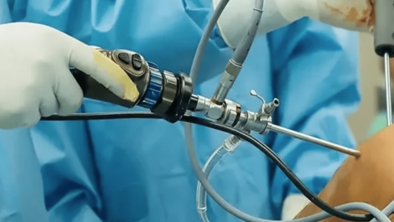 Foto - Uzmanından kritik uyarı: Dizde sesle birlikte ağrı, şişlik ve hareket kısıtlılığı varsa...