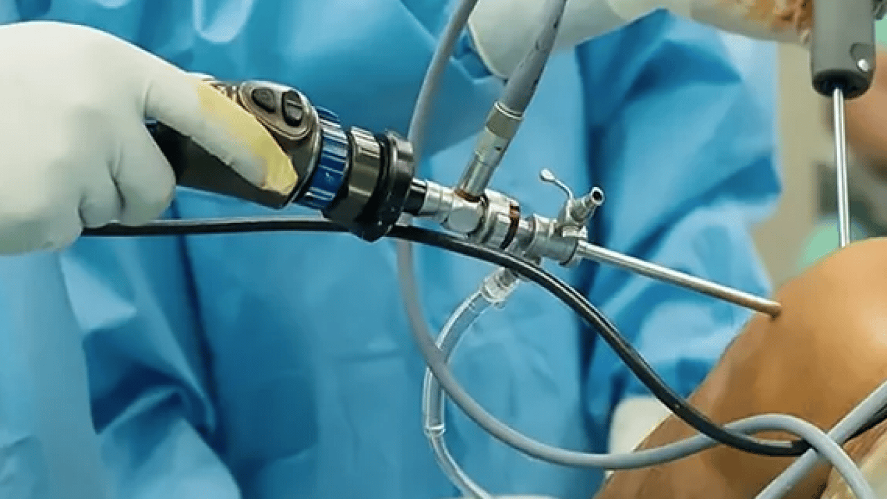 Foto - Uzmanından kritik uyarı: Dizde sesle birlikte ağrı, şişlik ve hareket kısıtlılığı varsa...