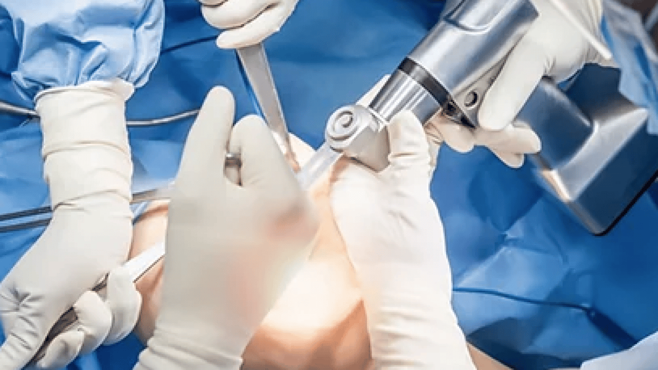 Foto - Uzmanından kritik uyarı: Dizde sesle birlikte ağrı, şişlik ve hareket kısıtlılığı varsa...