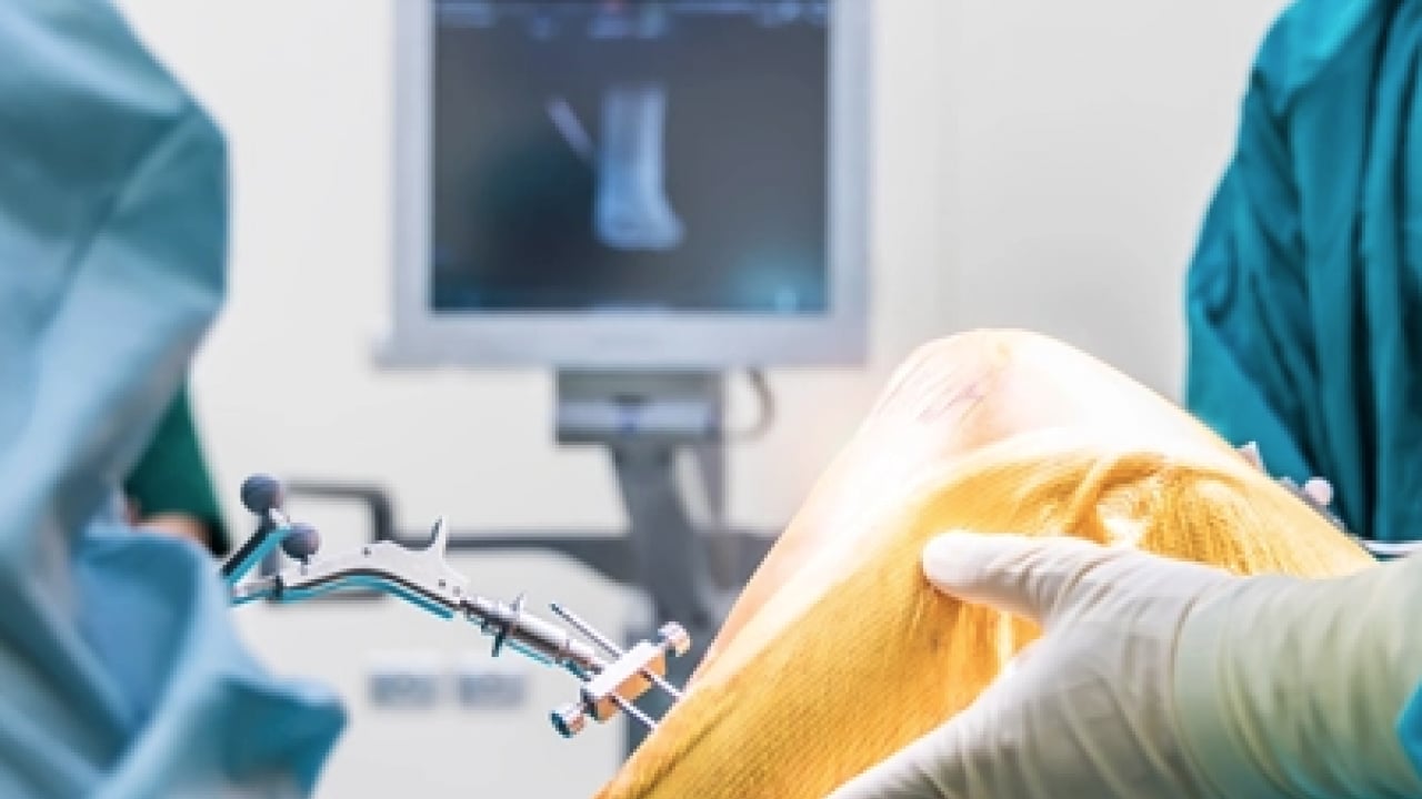 Foto - Uzmanından kritik uyarı: Dizde sesle birlikte ağrı, şişlik ve hareket kısıtlılığı varsa...