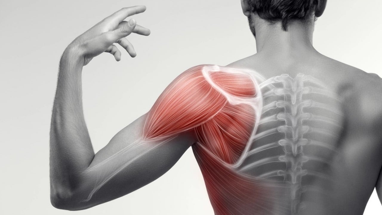 Foto - Uzmanından ‘omuz ağrısı’ uyarısı: Günlük hayatınızı zorlaştırır