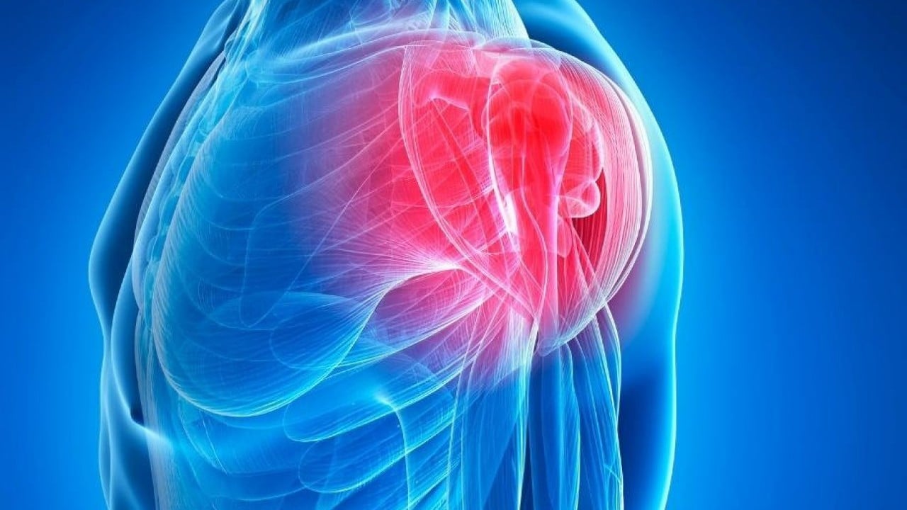 Foto - Uzmanından ‘omuz ağrısı’ uyarısı: Günlük hayatınızı zorlaştırır